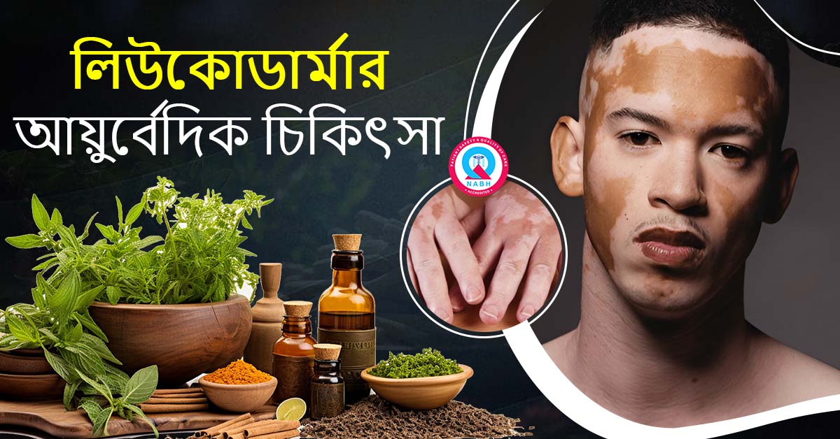লিউকোডার্মার-আয়ুর্বেদিক-চিকিৎসা